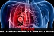 ETUDE : Des lésions pulmonaires à cause de la vapeur ?