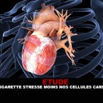 cardiaque