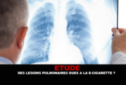 ÉTUDE : Des lésions pulmonaires dues à la e-cigarette ?