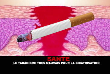 SANTE : Le tabagisme très mauvais pour la cicatrisation.