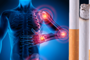 SANTE : Le tabac favorise le développement de maladies rhumatologiques