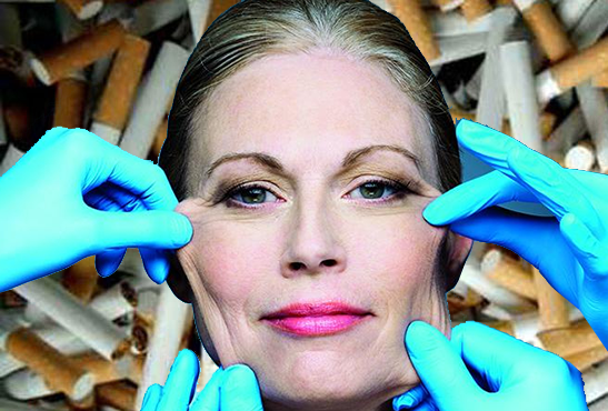 ETUDE : La chirurgie esthétique favorise l&rsquo;arrêt du tabac