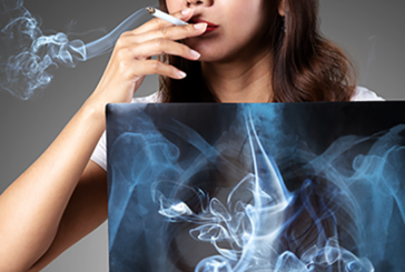 TABAC : Des pneumologues alertent les femmes sur le risque de BPCO