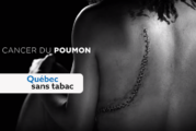 CANADA : Une campagne publicitaire montre les dégâts du tabagisme.