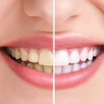 teeth