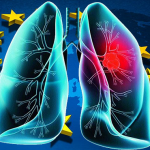 lung