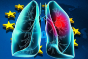 EUROPE : Plus de 273 000 décès dus au cancer du poumon en 2015