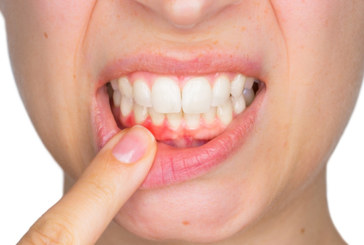 SANTÉ : Le vapotage, un risque pour votre santé bucco-dentaire ?