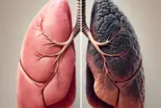Vapotage vs Tabac : ce que disent les spécialistes sur la santé pulmonaire